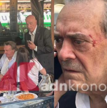 Barillari picchiato da Depardieu in via Veneto finisce in ospedale. Il fotoreporter: “Mo lo denuncio”
