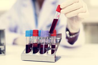 Parkinson, un test del sangue per scoprirlo 7 anni prima dei sintomi: la ricerca